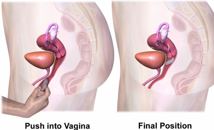 human reproductive organs